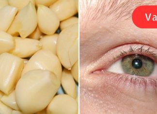 როგორ აღვადგინოთ მხედველობა ნიორით. არანაირი ოპერაციები!