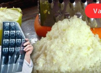 გაყინეთ ლიმონი და დაემშვიდობეთ დიაბეტს და სიმსუქნეს! არსებობს საიდუმლო საშუალება