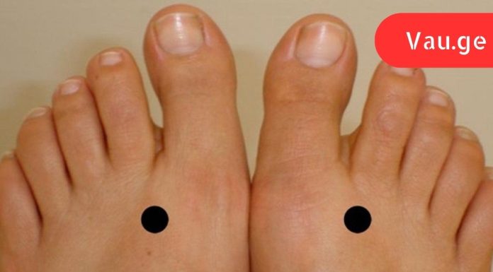 მან ფეხებზე ამ  წერტილებს დააჭირა, რის შემდეგაც მისი ტანჯვა დასრულდა!