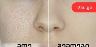 როგორ შევამციროთ გაფართოებული ფორები: 8 ეფექტური რეცეპტი!