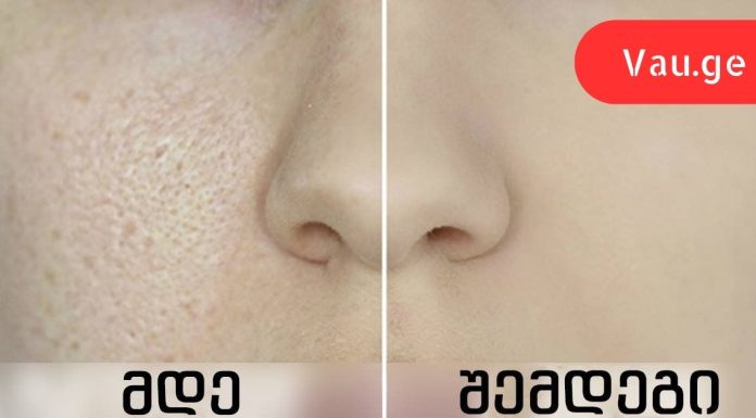 როგორ შევამციროთ გაფართოებული ფორები: 8 ეფექტური რეცეპტი!