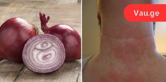 მან ღამით ხახვის კომპრესი გაიკეთა, დილით კი შედეგით უზომოდ გაკვირვებული დარჩა!