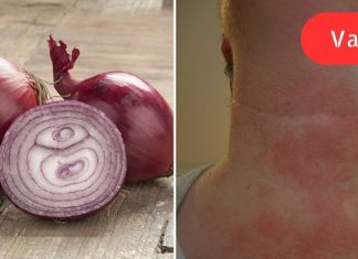 მან ღამით ხახვის კომპრესი გაიკეთა, დილით კი შედეგით უზომოდ გაკვირვებული დარჩა!