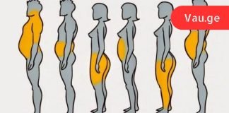 სიმსუქნის 6 ტიპი: იპოვე შენი ტიპი და ნახე როგორ უნდა მოიქცე ამ დროს!