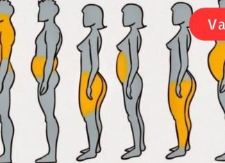 სიმსუქნის 6 ტიპი: იპოვე შენი ტიპი და ნახე როგორ უნდა მოიქცე ამ დროს!