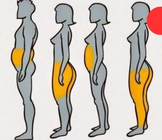 სიმსუქნის 6 ტიპი: იპოვე შენი ტიპი და ნახე როგორ უნდა მოიქცე ამ დროს!