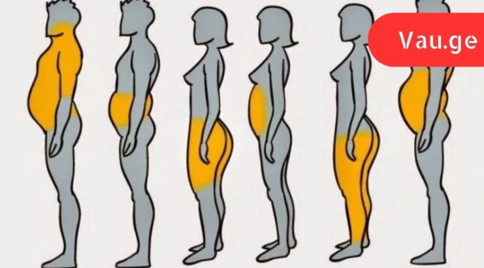 სიმსუქნის 6 ტიპი: იპოვე შენი ტიპი და ნახე როგორ უნდა მოიქცე ამ დროს!