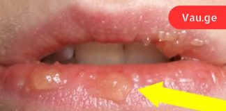 თუ საკუთარ თავში ეს ნიშნები შენიშნეთ, უმჯობესია დაუყოვნებლივ მიმართოთ ექიმს!