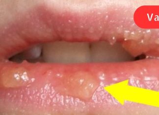 თუ საკუთარ თავში ეს ნიშნები შენიშნეთ, უმჯობესია დაუყოვნებლივ მიმართოთ ექიმს!