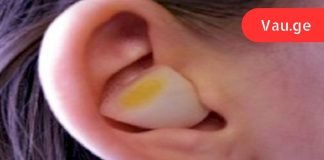 რატომ არ ვიცოდი ამის შესახებ ადრე?ასე ხდება, როდესაც ხახვის ნაჭერს ყურში ჩასვამთ.