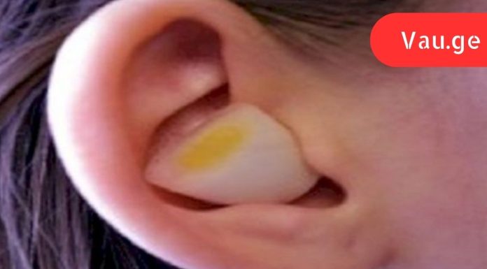 რატომ არ ვიცოდი ამის შესახებ ადრე?ასე ხდება, როდესაც ხახვის ნაჭერს ყურში ჩასვამთ.