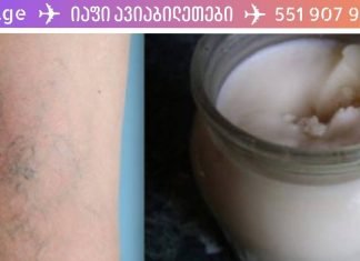 ჩვენი წინაპრების რეცეპტი: დავიწყებული ჯადოსნური მალამო ვარიკოზული ვენებისთვის