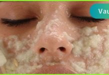 მხოლოდ ერთი ინგრედიენტი და დაივიწყებთ ფორებს თქვენს სახეზე! ჩემს თავზე გამოვცადე!