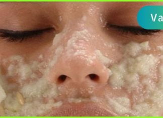 მხოლოდ ერთი ინგრედიენტი და დაივიწყებთ ფორებს თქვენს სახეზე! ჩემს თავზე გამოვცადე!