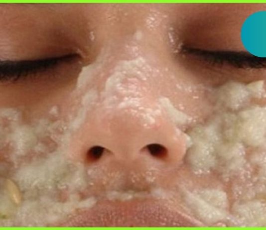 მხოლოდ ერთი ინგრედიენტი და დაივიწყებთ ფორებს თქვენს სახეზე! ჩემს თავზე გამოვცადე!