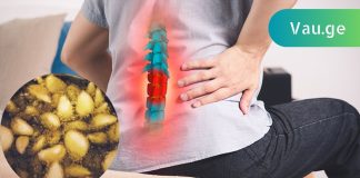 გაიქრეთ წელის თიაქარი ოპერაციის გარეშე!