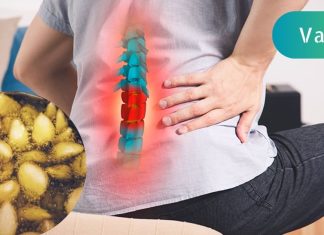 გაიქრეთ წელის თიაქარი ოპერაციის გარეშე!