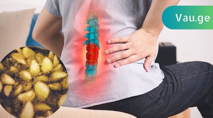 გაიქრეთ წელის თიაქარი ოპერაციის გარეშე!