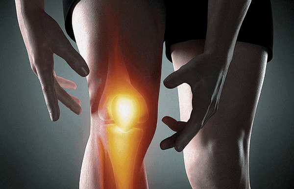 რაზე მიგვანიშნებს მუხლის ტკივილი – ოსტეოართროზი, ტრავმა თუ გადატვირთვა?